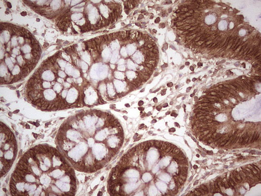 IHC of paraffin-embedded Human colon tissue using anti-WIBG mouse monoclonal antibody. (Heat-induced epitope retrieval by 1 mM EDTA in 10mM Tris, pH8.5, 120°C for 3min).