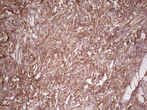 IHC of paraffin-embedded Human Ovary tissue using anti-WIBG mouse monoclonal antibody. (Heat-induced epitope retrieval by 1 mM EDTA in 10mM Tris, pH8.5, 120°C for 3min).