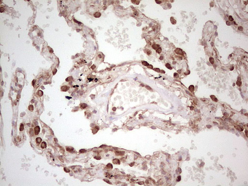 IHC of paraffin-embedded Human lung tissue using anti-WIBG mouse monoclonal antibody. (Heat-induced epitope retrieval by 1 mM EDTA in 10mM Tris, pH8.5, 120°C for 3min).
