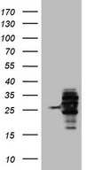 HEK293T cells were transfected with the pCMV6-ENTRY control (Left lane) or pCMV6-ENTRY WIBG (Right lane) cDNA for 48 hrs and lysed. Equivalent amounts of cell lysates (5 ug per lane) were separated by SDS-PAGE and immunoblotted with anti-WIBG.