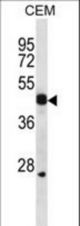 WIF1 Antibody western blot of CEM cell line lysates (35 ug/lane). The WIF1 antibody detected the WIF1 protein (arrow).