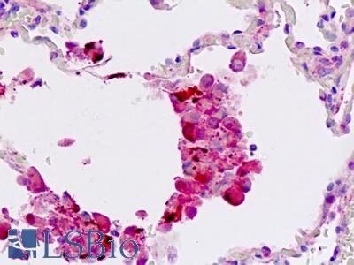 Human Lung: Formalin-Fixed, Paraffin-Embedded (FFPE)