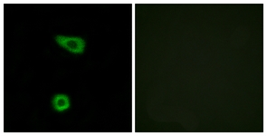 Immunofluorescence of HUVEC cells, using TNAP2 Antibody. The picture on the right is treated with the synthesized peptide.