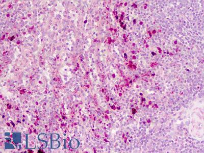 Human Spleen: Formalin-Fixed, Paraffin-Embedded (FFPE)