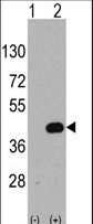 Western blot of WIF1 (arrow) using rabbit polyclonal WIF1 Antibody. 293 cell lysates (2 ug/lane) either nontransfected (Lane 1) or transiently transfected with the WIF1 gene (Lane 2) (Origene Technologies).