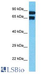 TNFAIP2 antibody Western Blot of MCF7. Antibody dilution: 1 ug/ml.