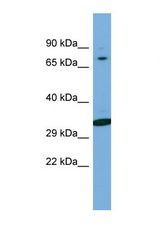 Western blot of Human Jurkat. WIPF2 antibody dilution 1.0 ug/ml.
