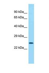 Western blot of Human Jurkat. TNFAIP2 antibody dilution 1.0 ug/ml.