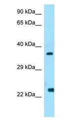 WISP2 antibody Western Blot of Human Placenta.