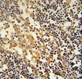 TNFAIP2 Antibody immunohistochemistry of formalin-fixed and paraffin-embedded human lymph node followed by peroxidase-conjugated secondary antibody and DAB staining.