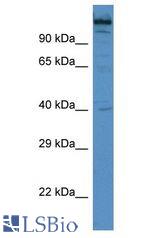 WIZ antibody Western Blot of Mouse Spleen. Antibody dilution: 1 ug/ml.