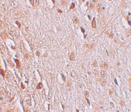 Immunohistochemistry of WIZ in human brain tissue with WIZ antibody at 2.5 ug/ml.