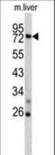 Western blot of TNFAIP2 antibody in mouse liver lysates (35 ug/lane). TNFAIP2 (arrow) was detected using the purified antibody.
