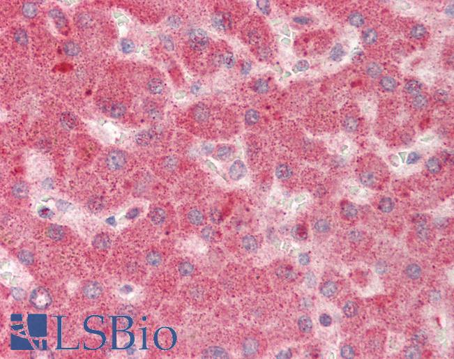Human Liver: Formalin-Fixed, Paraffin-Embedded (FFPE)