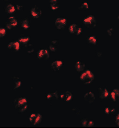 Immunofluorescence of TNFAIP2 in K562 cells with TNFAIP2 antibody at 20 ug/ml.