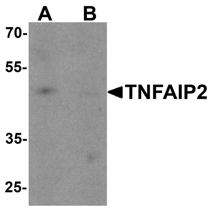 Western blot analysis of TNFAIP2 in K562 cell lysate with TNFAIP2 antibody at 1 ug/ml in (A) the absence and (B) the presence of blocking peptide.