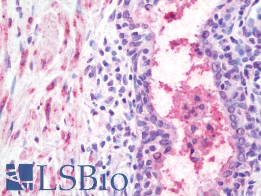 Human Prostate: Formalin-Fixed, Paraffin-Embedded (FFPE)