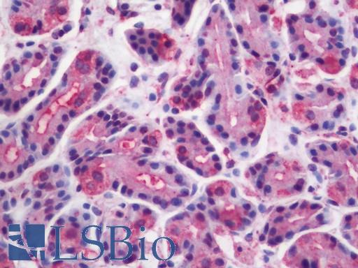 Human Stomach: Formalin-Fixed, Paraffin-Embedded (FFPE)