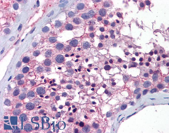 Anti-WNT10A antibody IHC of human testis. Immunohistochemistry of formalin-fixed, paraffin-embedded tissue after heat-induced antigen retrieval. Antibody LS-B5887 concentration 5 ug/ml.