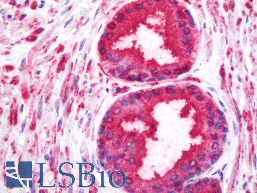 Human Prostate: Formalin-Fixed, Paraffin-Embedded (FFPE)