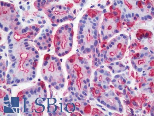 Human Stomach: Formalin-Fixed, Paraffin-Embedded (FFPE)