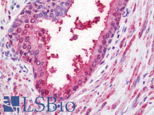 Human Prostate: Formalin-Fixed, Paraffin-Embedded (FFPE)