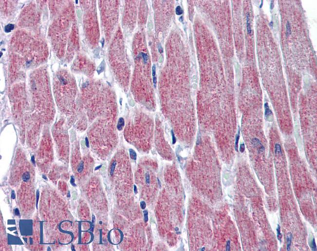 Anti-WNT10B antibody IHC of human heart. Immunohistochemistry of formalin-fixed, paraffin-embedded tissue after heat-induced antigen retrieval. Antibody LS-B5721 concentration 5 ug/ml.