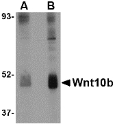 Western blot of Wnt10b in human skeletal muscle tissue lysate with Wnt10b antibody at (A) 2 and (B) 4 ug/ml.