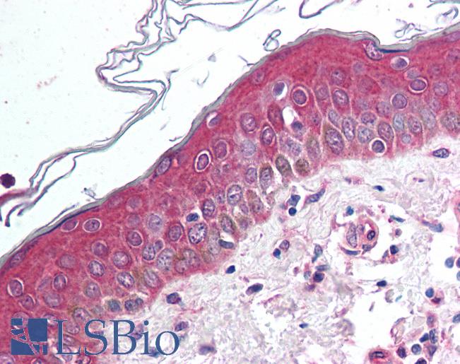Anti-WNT10B antibody LS-A9626 IHC of human skin. Immunohistochemistry of formalin-fixed, paraffin-embedded tissue after heat-induced antigen retrieval.