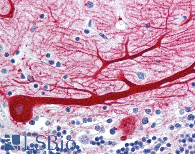 Anti-WNT10B antibody LS-A9627 IHC of human brain, cerebellum. Immunohistochemistry of formalin-fixed, paraffin-embedded tissue after heat-induced antigen retrieval.
