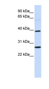 WNT16 antibody LS-C101904 Western blot of Fetal Brain lysate.