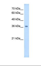 HepG2 cell lysate. Antibody concentration: 2.5 ug/ml. Gel concentration: 12%.