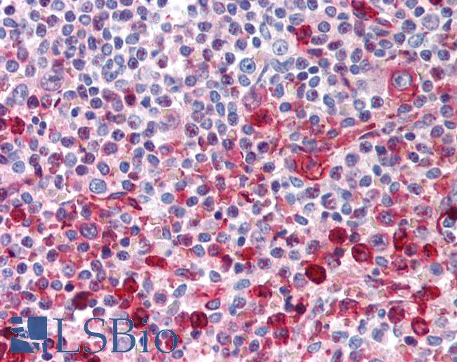 Anti-WNT16 antibody LS-A9630 IHC of human spleen. Immunohistochemistry of formalin-fixed, paraffin-embedded tissue after heat-induced antigen retrieval.