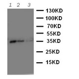 WB of WNT2B antibody. Recombinant Protein Detection Source:. E.coli derived -recombinant Human WNT2B, 35.78KD. (162aa tag+ R101-A254). . Lane 1: Recombinant Human WNT2B Protein 10ng. Lane 2: Recombinant Human WNT2B Protein 5ng. Lane 3: Recombinant Human WNT2B Protein 2.5ng.