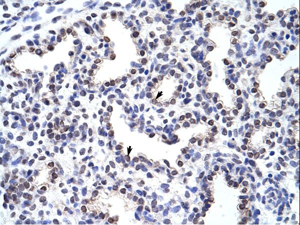 WNT2B antibody LS-C31588 was used in IHC to stain formalin-fixed, paraffin-embedded human lung.