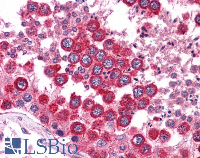 Anti-WNT2B antibody IHC of human testis. Immunohistochemistry of formalin-fixed, paraffin-embedded tissue after heat-induced antigen retrieval. Antibody LS-B4585 concentration 5 ug/ml.