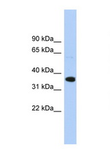 WNT2B antibody LS-B6820 Western blot of HepG2 Cell lysate. Antibody concentration 1 ug/ml.