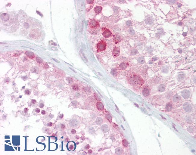 Anti-WNT2B antibody IHC of human testis. Immunohistochemistry of formalin-fixed, paraffin-embedded tissue after heat-induced antigen retrieval. Antibody LS-B6821 concentration 5 ug/ml.