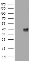 HEK293T cells were transfected with the pCMV6-ENTRY control (Left lane) or pCMV6-ENTRY WNT3 (Right lane) cDNA for 48 hrs and lysed. Equivalent amounts of cell lysates (5 ug per lane) were separated by SDS-PAGE and immunoblotted with anti-WNT3.