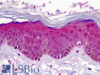 Anti-WNT3A antibody IHC of human skin. Immunohistochemistry of formalin-fixed, paraffin-embedded tissue after heat-induced antigen retrieval. Antibody LS-B4946 concentration 5 ug/ml.