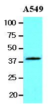 The lysates of A549 (20 ug) were resolved by SDS-PAGE, transferred to NC membrane and probed with anti-human Wnt3a (1:1000). Proteins were visualized using a goat anti-mouse secondary antibody conjugated to HRP and an ECL detection system.