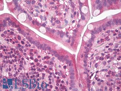 Anti-WNT3A antibody IHC of human small intestine. Immunohistochemistry of formalin-fixed, paraffin-embedded tissue after heat-induced antigen retrieval. Antibody LS-B8210 dilution 5 ug/ml.