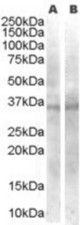 Staining (0.03 ug/ml) of a) Human Ovary and b) Human Testis (RIPA buffer, 35 ug total protein per lane). Primary incubated for 1 hour. Detected by chemiluminescence.