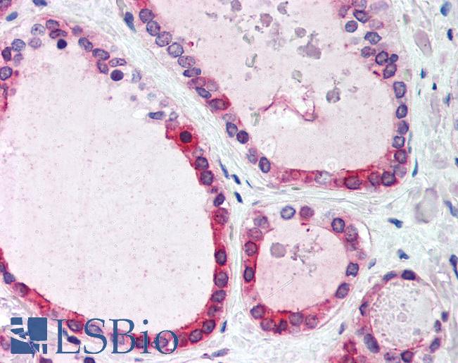 Anti-WNT4 antibody LS-A9623 IHC of human thyroid. Immunohistochemistry of formalin-fixed, paraffin-embedded tissue after heat-induced antigen retrieval.