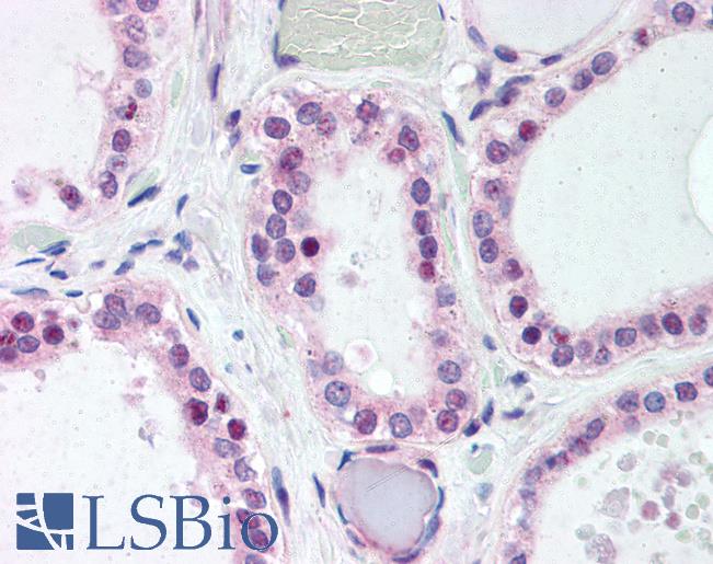 Anti-WNT4 antibody LS-A9622 IHC of human thyroid. Immunohistochemistry of formalin-fixed, paraffin-embedded tissue after heat-induced antigen retrieval.