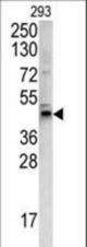 Western blot of WNT4 antibody in 293 cell line lysates (35 ug/lane). WNT4 (arrow) was detected using the purified antibody.