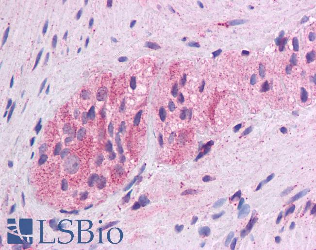 Anti-WNT5A antibody IHC of human colon, myenteric plexus. Immunohistochemistry of formalin-fixed, paraffin-embedded tissue after heat-induced antigen retrieval. Antibody LS-B4565 concentration 5 ug/ml.