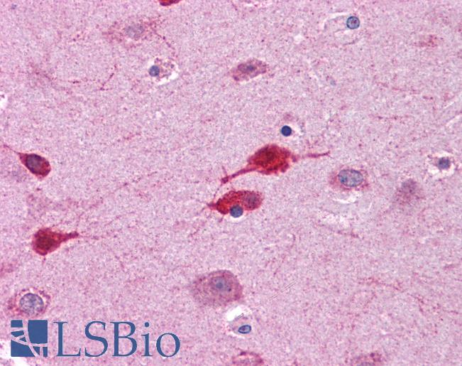 Anti-WNT5A antibody IHC of human brain, cortex. Immunohistochemistry of formalin-fixed, paraffin-embedded tissue after heat-induced antigen retrieval. Antibody LS-B4565 concentration 5 ug/ml.