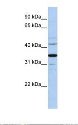 Hela cell lysate. Antibody concentration: 1.0 ug/ml. Gel concentration: 12%.
