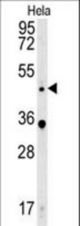 WNT5A Antibody western blot of HeLa cell line lysates (35 ug/lane). The WNT5A antibody detected the WNT5A protein (arrow).